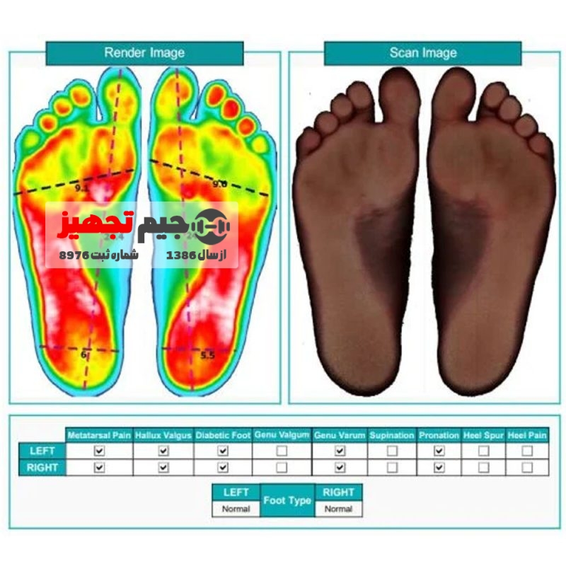 تفاوت دستگاه اسکن کف پا اپتیکال با اسکنر فشار و اسکنر سه بعدی چیست؟ دستگاه اسکن دو بعدی کف پا در واقع فوت سایزهای دیجیتال هستند. این ابزار از یک اسکنر دو بعدی که برای اسکن متن و کاغذ استفاده می شود ساخته شده است. اسکنر نوری درون یک قاب با شیشه قطور قرار گرفته و در واقع یک عکس با ابعاد واقعی از کف پا می گیرد. در این اسکنرها هیچ سنسوری برای سنجش فشار و یا ارتفاع قوسی وجود ندارد. در این مدل اسکنر کف پا با استفاده از تصویرسازی و تغییر رنگ قسمت های مختلف کف پا شبیه سازی فشار در قسمت های مختلف کف پا نمایش داده میشود، اما امکان اندازه گیری دقیق فشار کف پا وجود ندارد.توضیحات کاملتری جهت آشنایی با انواع فوت اسکنرها در مقاله ” آشنایی با انواع اسکنر پا” ارائه شده است. ویژگی های اسکنر دو بعدی کف پا پایاتک : انجام اسکن دو پا در کوتاهترین زمان ( کمتر از 8 ثانیه ) سبک و قابل حمل تحمل وزن تا 150 کیلوگرم اتصال آسان به کامپیوتر تنها با یک کابل USB امکان استفاده حتی در فضاهای کوچک استفاده از نرم افزار جامع PT-Scan Suit با قابلیت ثبت اسکن در پرونده مراجعه کننده