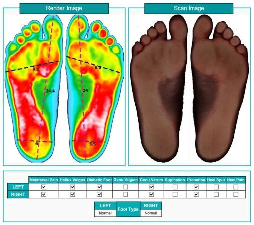 2D foot scanner