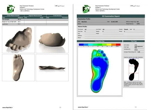 3D foot scanner